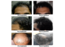 Hair Growth Treatment Secrets Bollywood Will Never Tell You About
