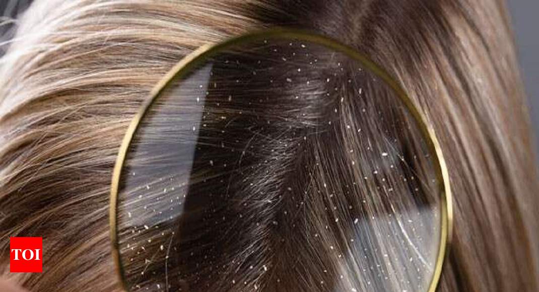 Anti-dandruff conditioner: Say no to flaky, and itchy scalp - Times of India