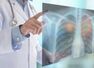 Is air pollution linked to Lung Cancer?