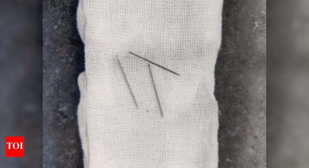 Ahmedabad: Three needles removed from woman’s body | Ahmedabad News ...