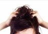 10 home remedies for itchy scalp