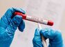 Delhi: COVID negative report mandatory for those coming from these 5 states
