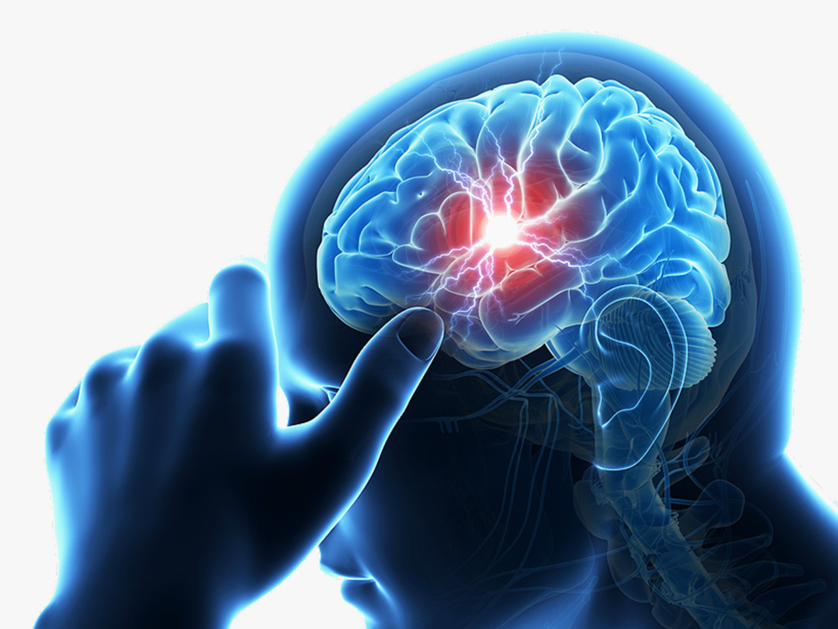 Stroke: Facts and ways to prevent it