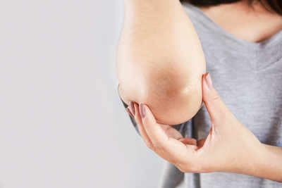How to lighten dark knees and elbows naturally