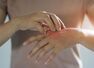 How to locate COVID-19 on your skin