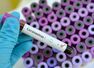 Blood type O has lower COVID contraction risk