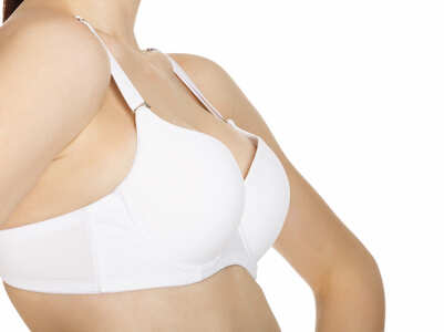 Home remedies for sagging breasts