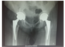 Evolving dynamics in total hip replacement patient care