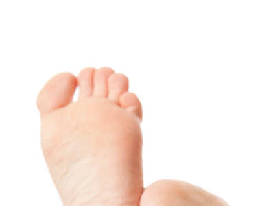 Home remedies for cracked heels