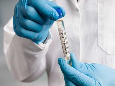Do you need an antibody test after vaccination?
