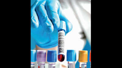 Rajkot: Pneumonia catching young Covid patients this time