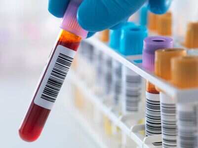 Study: Blood types do not affect COVID-19 risks