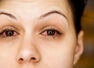 Do not ignore these atypical signs of COVID
