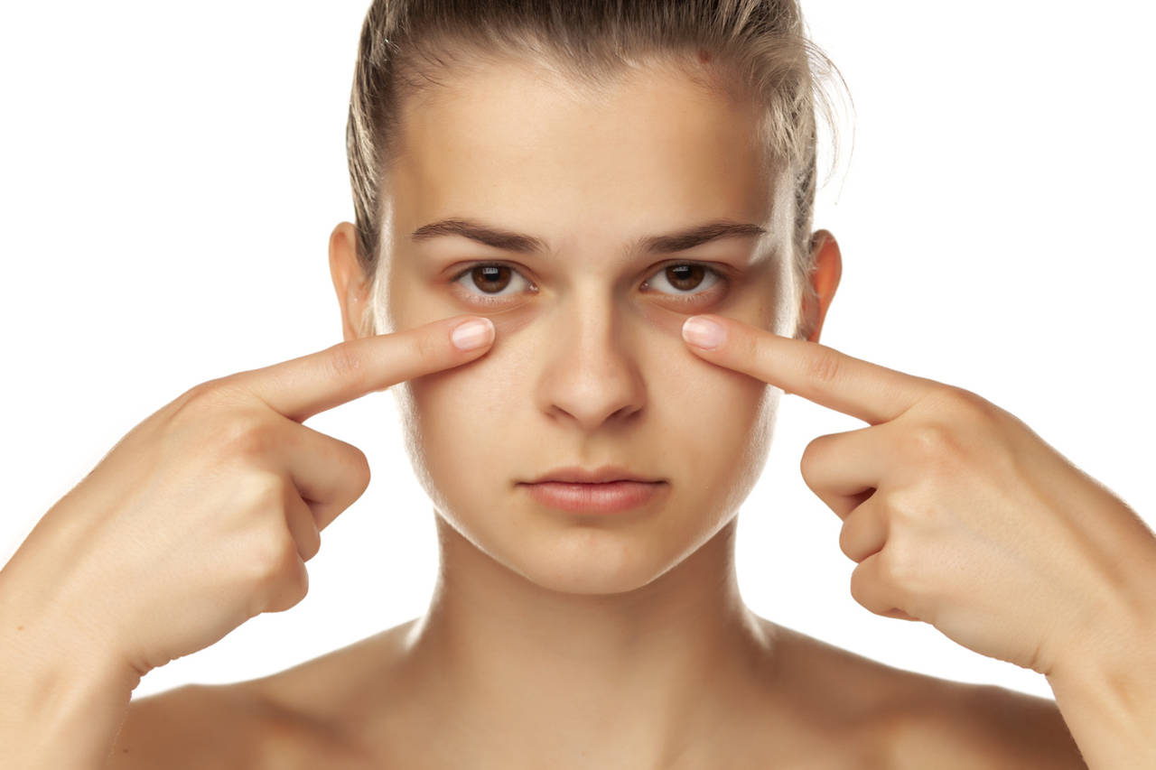 Dark circles and their treatment - Times of India