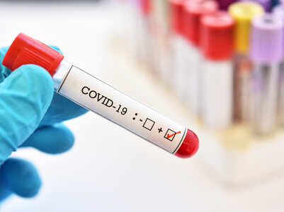 COVID-19 : What does a high viral load mean
