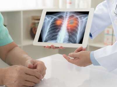 When should Covid-19 patients get an HRCT report?