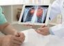 When should Covid-19 patients get an HRCT report?