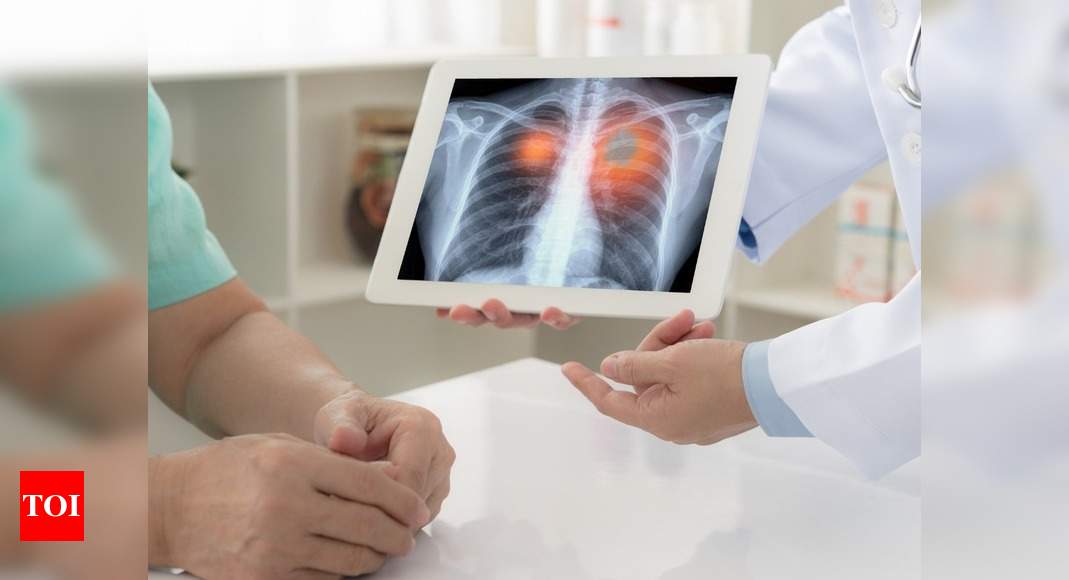 pulmonary-insights-hrct-is-cost-effective-in-screening-for-diffuse