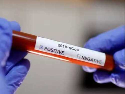 6 more die in Meghalaya, 246 test positive