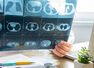 Frequent CT scan can increase the risk of cancer