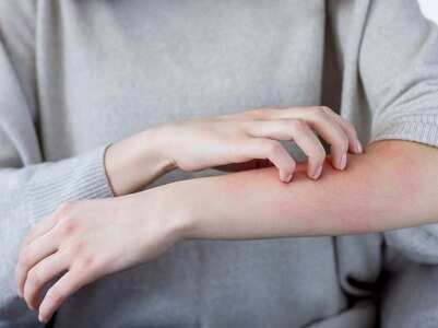 5 signs of skin infection in COVID-19
