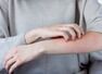 5 signs of skin infection in COVID-19