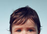 Top summer infections to watch out for in kids