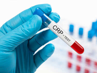 What is a CRP test and who should get it done
