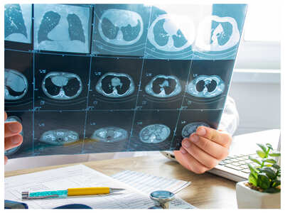 Are CT scans being used indiscriminately?