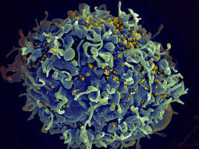 Four decades on, where's the HIV vaccine?