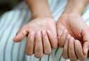 COVID nails could be a sign that you have had COVID: Here's how to identify it
