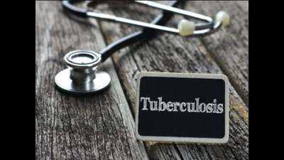 Goa: 20% of tuberculosis hospital beds occupied by post-Covid cases
