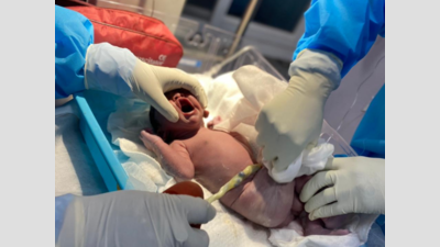 Andhra Pradesh: Corona patient on ventilator gives birth to baby