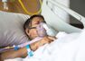 Severe COVID, oxygen therapy may reduce gray matter in the brain