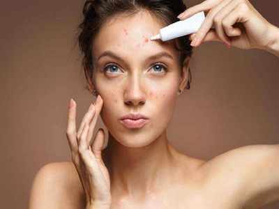 Acne prone skin: Trust these skincare products to get rid of acne