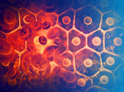 Symptoms and treatment for Sickle Cell Disease