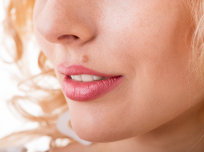 What moles reveal about your personality