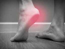 Plantar Fasciitis