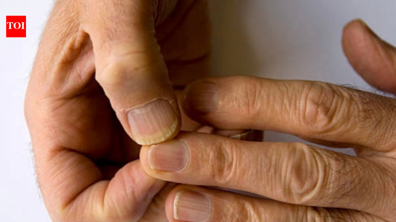 What the texture and colour of your nails can tell you about your health