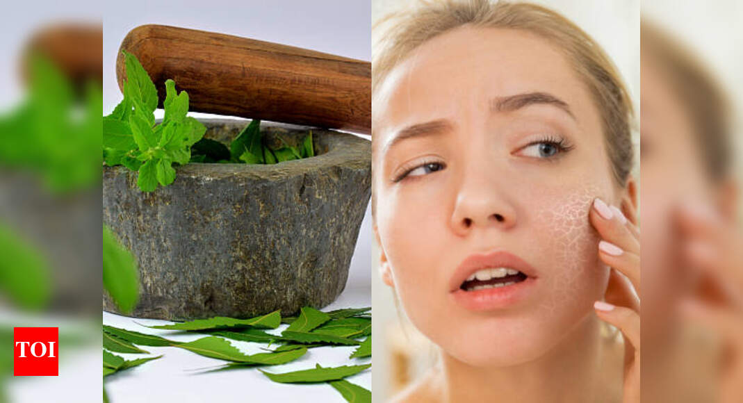 Top 5 Ayurvedic Herbs for treating flaky skin Times of India