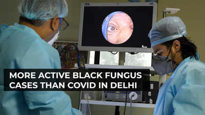 More active black fungus cases than Covid in Delhi