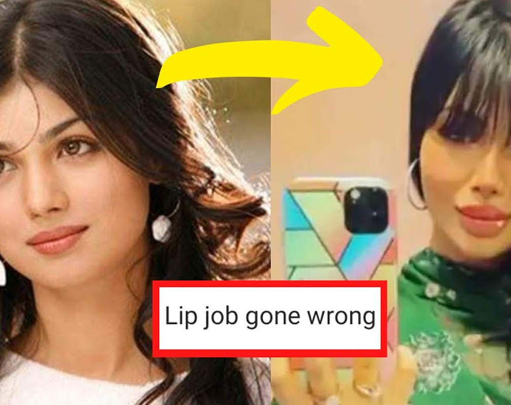 
Ayesha Takia gets trolled after netizens point out 'failed lip job'
