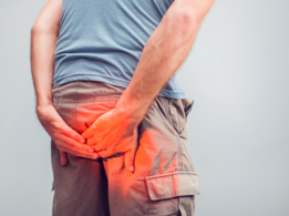 Hemorrhoids