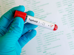 Typhoid