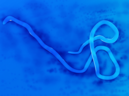 Ebola Virus