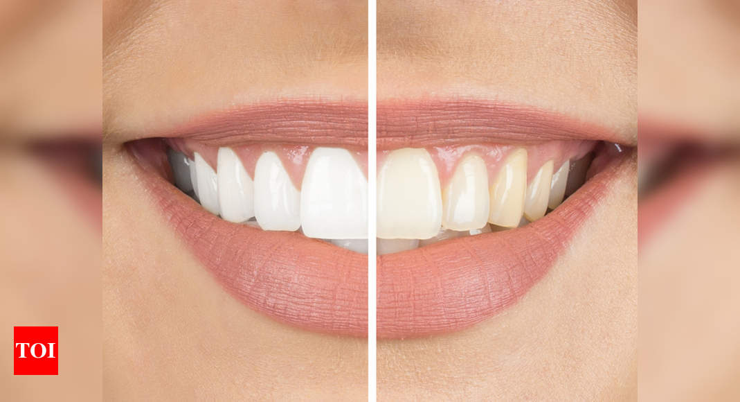 Whitening teeth How To