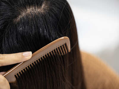 Hair Care: DIY remedies for oily scalp