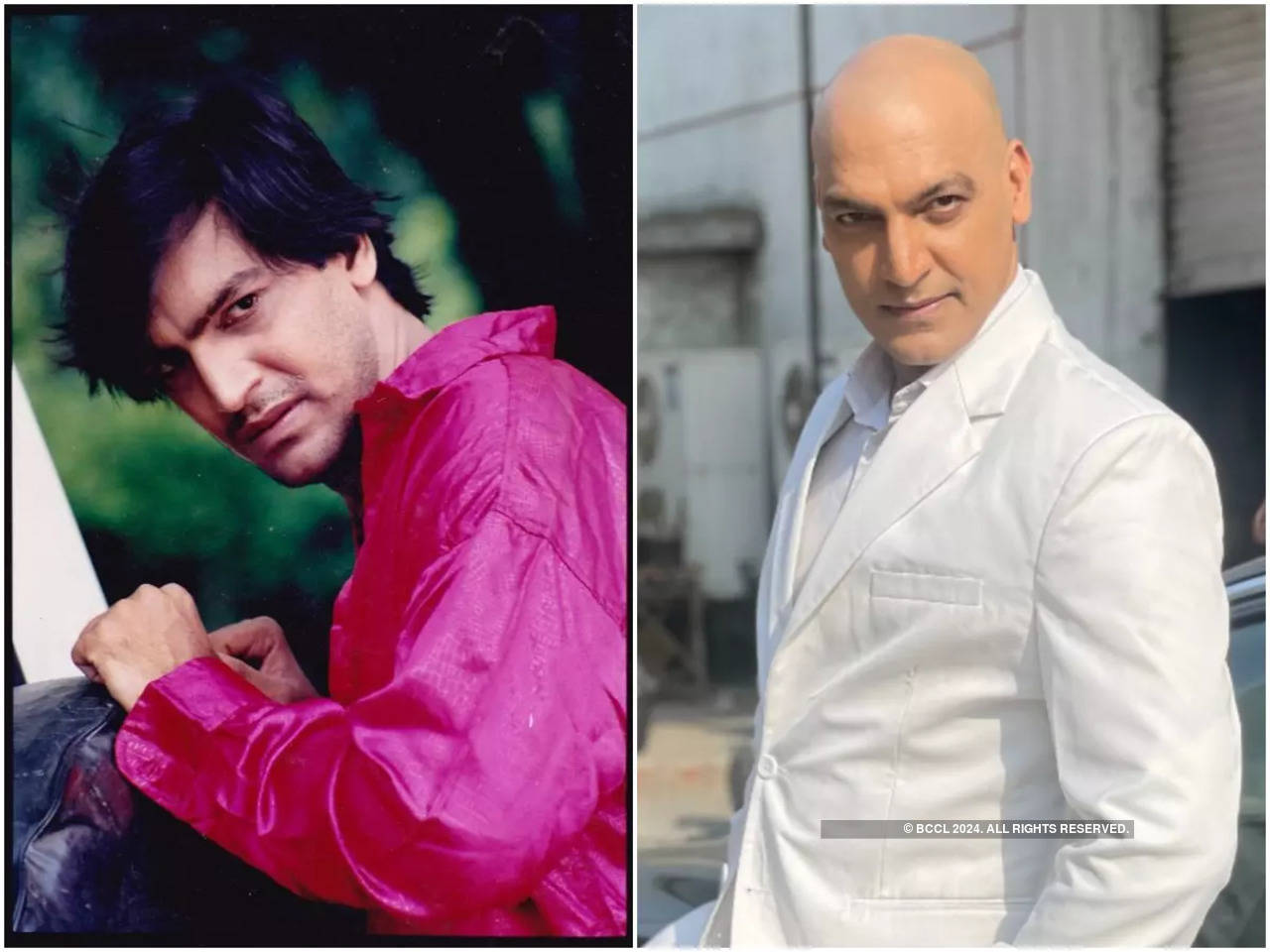 I went bald 11 years ago and people have not let me grow my hair ever  since, says Manish Wadhwa - Times of India
