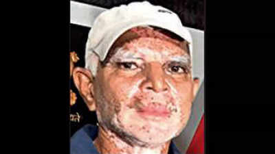 Telangana: 65-year-old Maoist surrenders in Khammam