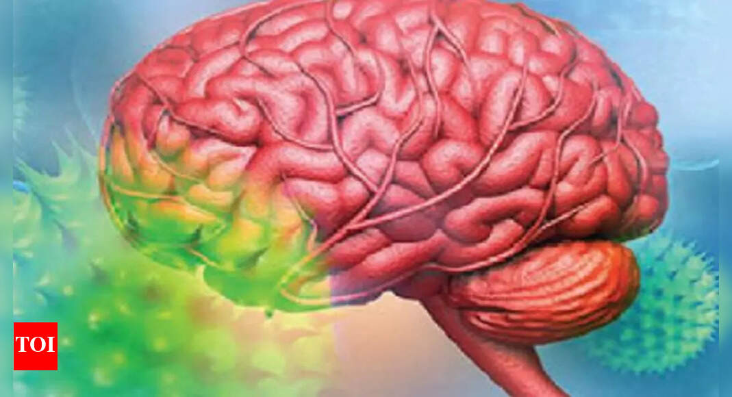 Electrodes in brain new hope for severe cases of epilepsy Delhi News